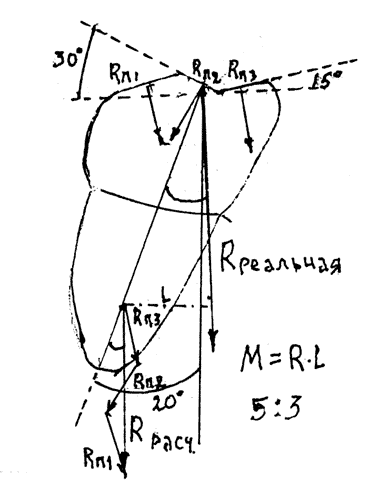 Рис. 2. Сила общей реакции (R реальная) на расстоянии плеча силы L от оси или под углом к оси (нагрузка на всю жевательную поверхность)